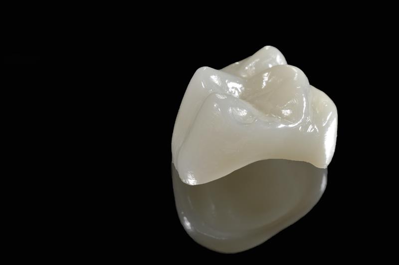 Porcelain Crowns Roseville, CA